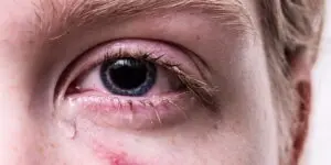 Tipps gegen trockene Augen