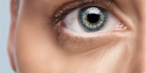 multifokalen Kontaktlinsen